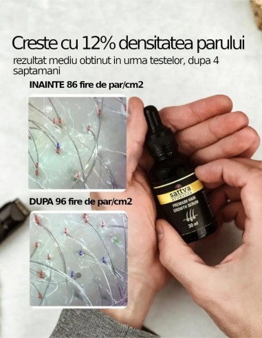 Ser pentru cresterea parului, barbati si femei, 30ml – Sattva Ayurveda